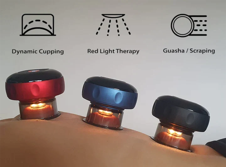 SmartCup — Cupping Therapy Device