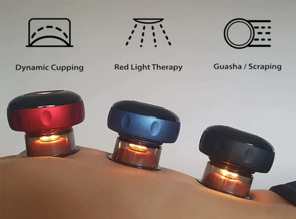 SmartCup — Cupping Therapy Device
